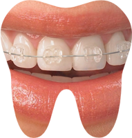 brackets esteticos